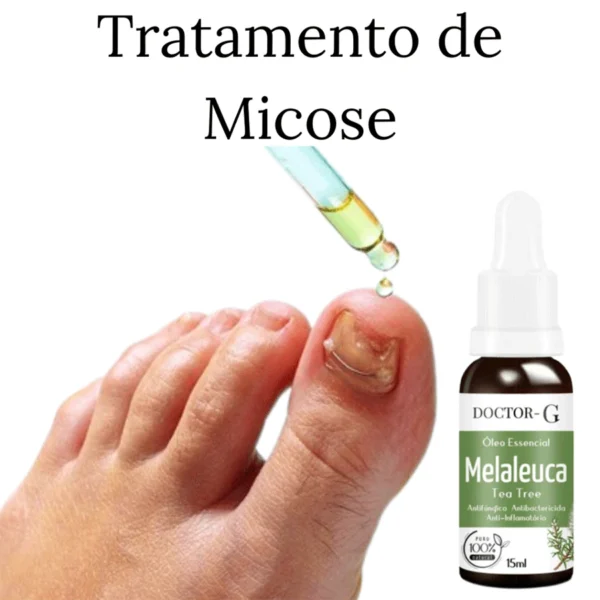 Óleo Essencial 100% Puro de Melaleuca Tea Tree 15ML GadioWay